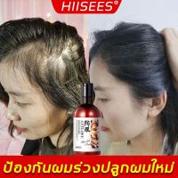 Hanse แชมพูแก้ผมร่วง 250ml สดชื่นคุมมัน รากผมแข็งแรง แก้ปัญหาผมร่วง,แชมพูขิงเพียว ยาสระผมขิง แชมพูลดผมร่วง แชมพูสมุนไพร