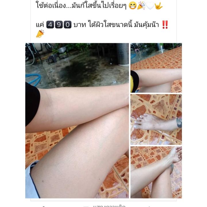 ไม่ขาวคืนเงิน-หัวเชื้อ-white-nbsp-skin-หัวเชื้อเร่งขาว-หัวเชื้อผิวขาว-หัวเชื้อคลินิค-เห็นผล100-เมื่อใช้-2-3-กระปุก