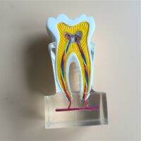 Dental Anatomical Molar Model Molar Inner Structure With Nerves And Vessels Teeth Model 2018