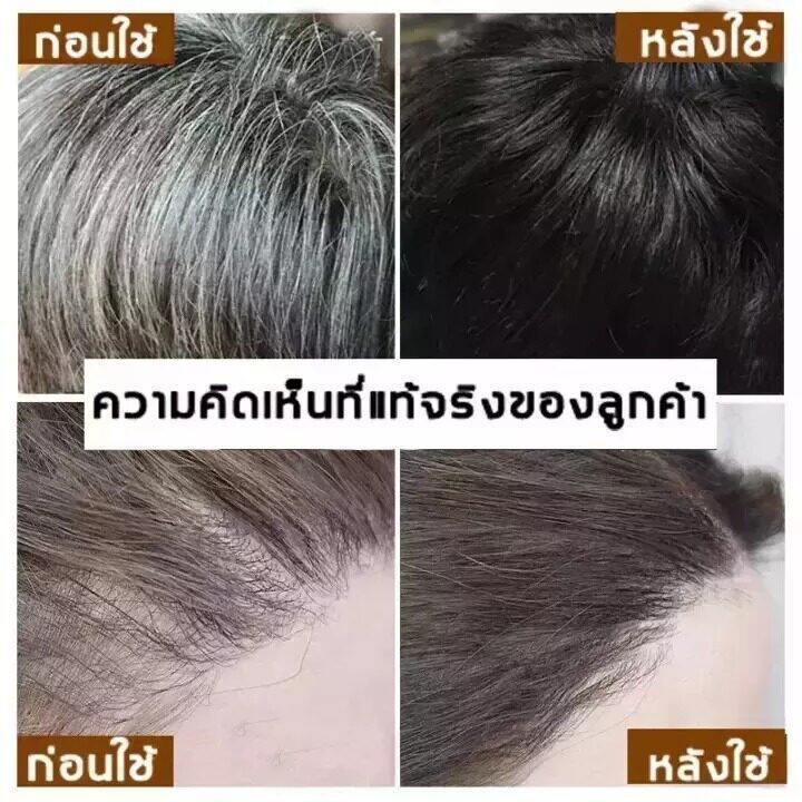 ผมหงอกกลับมาดำ-100ml-น้ำยาแก้ผมหงอก-ผมหงอกกลับมาดำ-แก้ผมหงอกถาวร-ยาแก้ผมหงอก-ผมขาวเป็นสีดำโดยไม่ต้องย้อนสี-ยาสระผมสมุนไพร-ยาแก้ผมหงอก-แชมพูสระผมหงอก-ครีมปิดผมขาว-เซรั่มแก้ผมหงอก-ผมหงอกกลับมาดำ-สมุนไพร