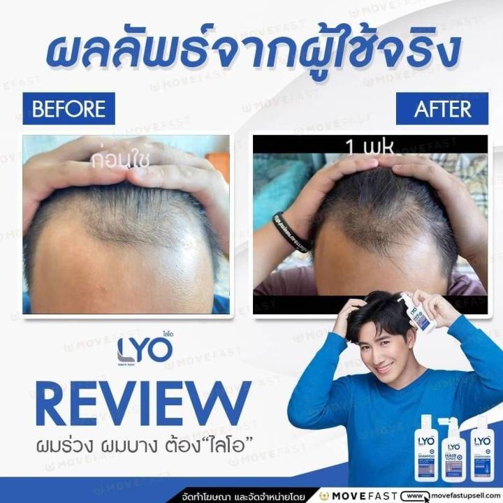 โปรพิเศษ-ซื้อ1แถม2-lyo-ไลโอแฮร์โทนิค-1-ขวด-แถม-ไลโอแชมพู-1-ขวด-ไลโอครีมนวดผม-1-ขวด