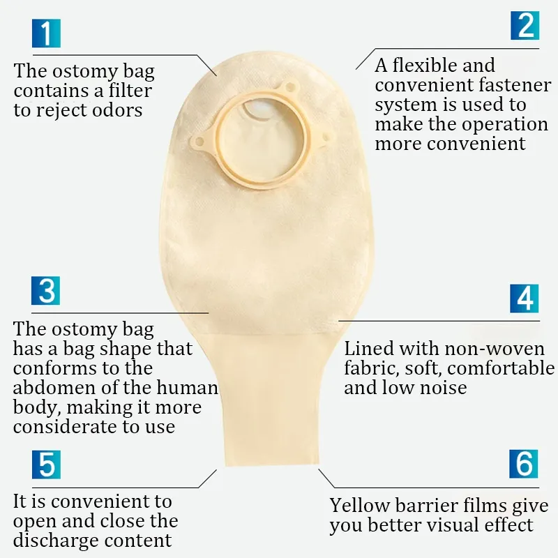 Discover 148+ colorectal bag esthdonghoadian