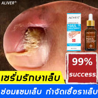 【ผู้ขายในท้องถิ่น】Aliver เซรั่มบำรุงเล็บ 30ML ลากับเล็บเสีย ไม่ทำร้ายเล็บดี ห่างกับปัญหาเล็บ (เชื้อราที่เล็บ ยาทาเชื้อราที่เล็บ ยาแก้เล็บขบ เชื้อราเล็บมือ ครีบบำรุงเล็บ เซรั่มเชื้อราเล็บ น้ำยาเล็บขบ) nail fungus