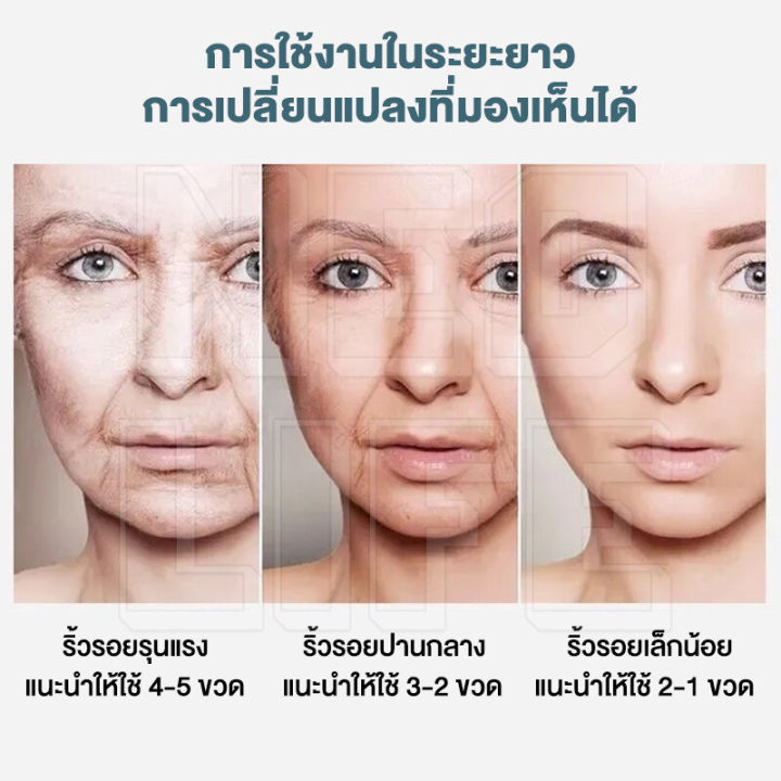 พร้อมส่ง-ครีมบำรุงผิวหน้า-ครีมยกกระชับผิวหน้า-ครีมต่อต้านริ้วรอย-ครีมลดริ้วรอย-ริ้วรอยร่องแก้มและรอยตีนกา-ลดริ้ยรอยบนหน้าผาก-ทีลดเลือนริ้วรอย-ครีมให้ความชุ่มชื้น-ครีมทาหน้า-wrinkle-cream-ครีมไวท์เทนนิ