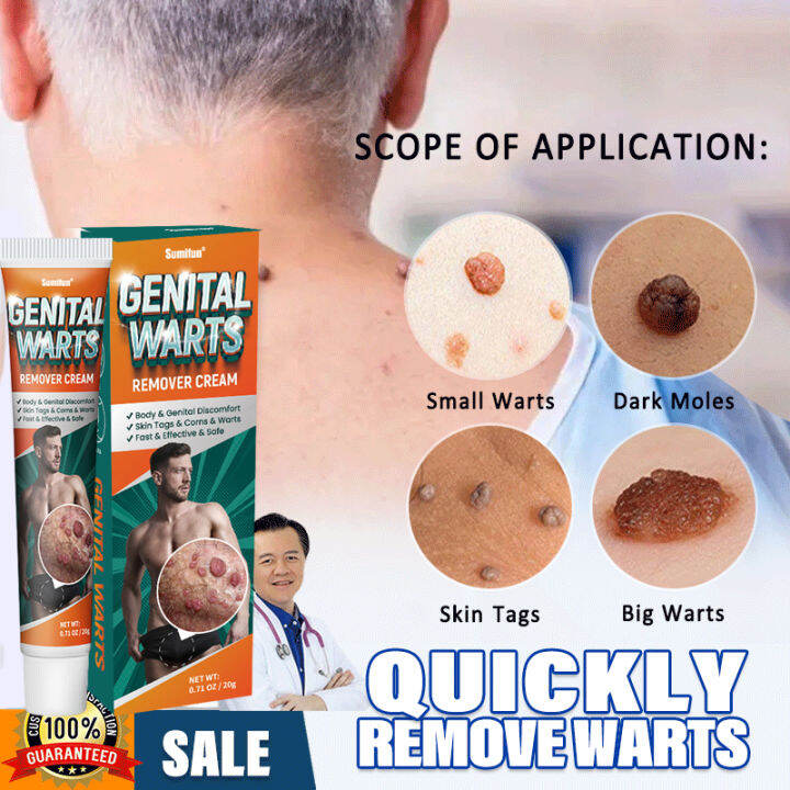 💯 Original Authentic Private Genital Warts Remover Cream Ointment