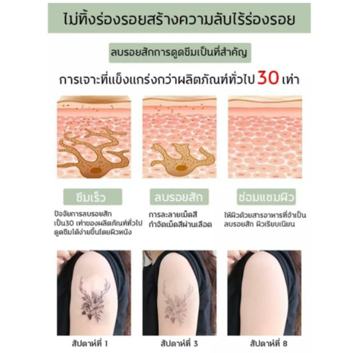 qaolna-น้ำยาลบรอยสัก-30ml-ประกอบด้วยสารสกัดจากพืช-สามารถล้างออกไปทางตกค้างบนผิวโดยรอยสัก-ดินสอเขียนคิ้ว-ครีมลบรอยสัก-น้ำลบรอยสักคิ้ว