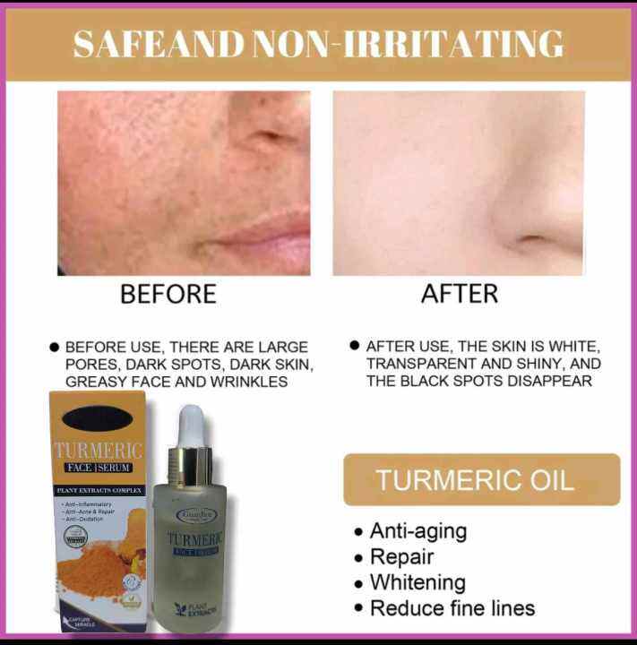 Turmeric Face Serum 30 ml Lazada PH