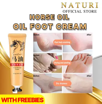 Shop Cracked Heel Remover Lotion with great discounts and prices online -  Oct 2023