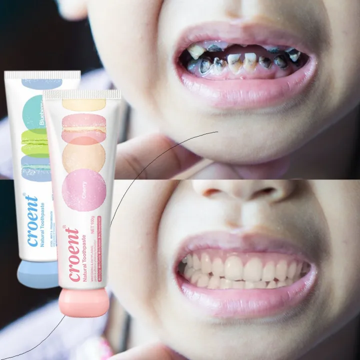 Baby toothpaste anticavity toothpaste 100g children's toothpaste