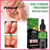 PETINAIL 50Ml New Repair Liquid Healthy Nail Care Anti-Fungal Foot Treatment Solution Fungal Remove Onychomycosis