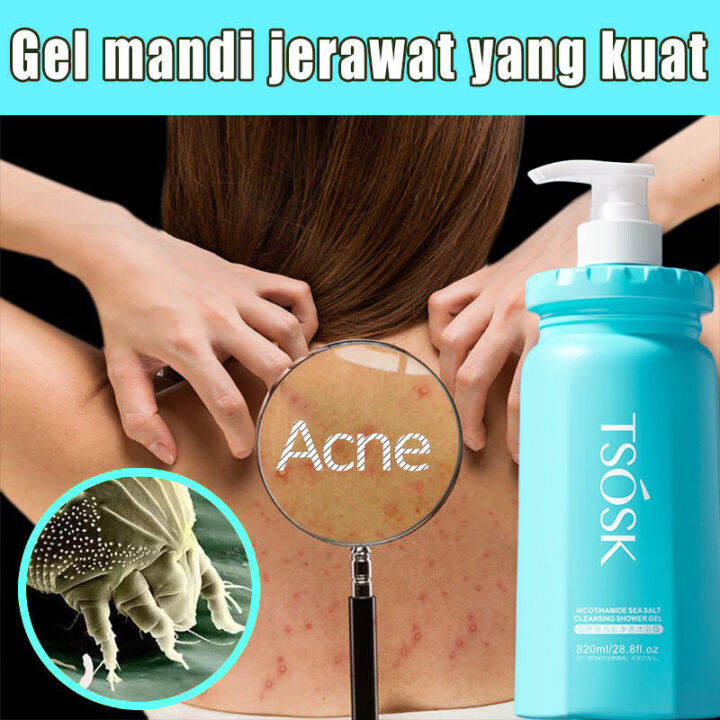 Acne body wash eczema body wash body acne body wash t3 acne body wash
