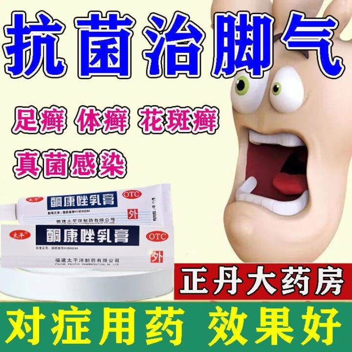 Treatment of athlete's foot ketoconazole ointment antifungal infection tinea manus fungal cream