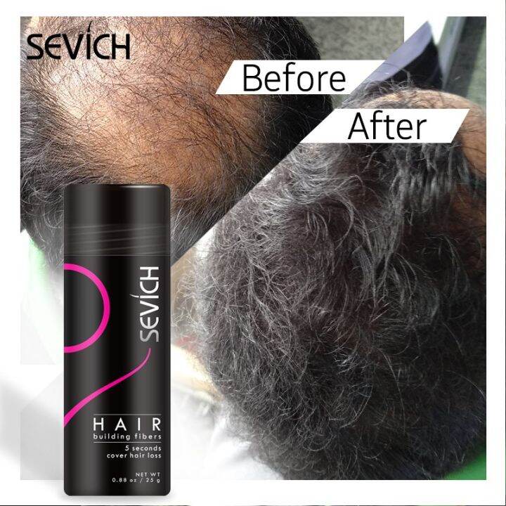 sevich-hair-fiber-25g-ผงไฟเบอร์-เพิ่มเส้นผม-สำหรับ-หัวล้าน-ผมบาง-เสริมความมั่นใจ