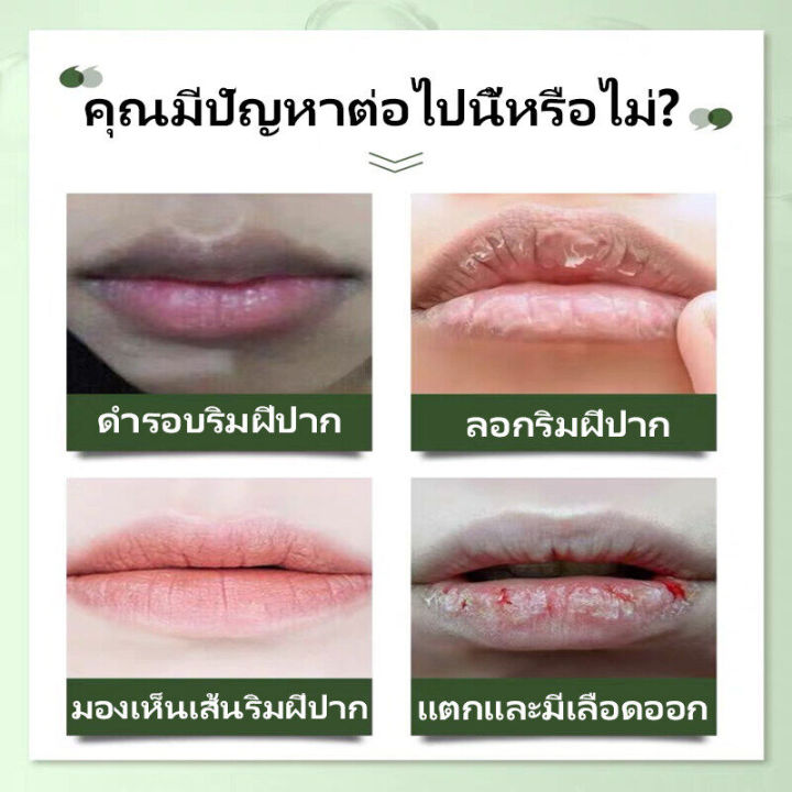 แก้ปากดำ-ปรับปรุงความหมองคล้ำ-เลือนริ้วรอยริมฝีปาก-kinde-ลิปบำรุงปากค้ำ-ให้ความชุ่มชื้นบำรุงริมฝีปากให้นุ่มชุ่มชื้น-ให้อมชมพู-ทาแก้ปากดำ-ชุ่มชื่นริมฝีปาก-ผลิตภัณฑ์บำรุงริมฝีปาก-ครีมทาแก้ปากดำ-ครีมแก้ร