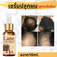 ?สินค้าขายดี?  ปลูกผมใบฝรั่ง ปลูกผมเร่งด่วน ปลูกผมชาย ปลูกผมหนา  ยาปลูกผมของแท้ ยาปลูกขนคิ้ว น้ำยาปลูกผม X1