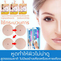 ส่งของจากไทย ขี้แมลงวัน หูดตาปลาและติ่งเนื้อ ของแท้ Corns warts removal พร้อมส่ง ไฝ ไฝ แต้ม ทาไฝ ทาขี้แมลงวัน ไพลิน