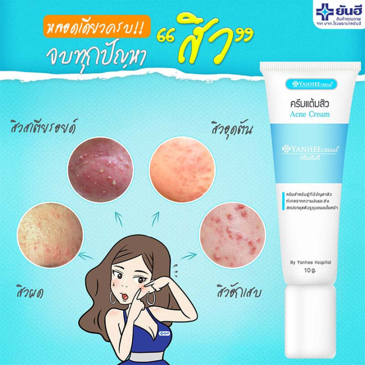 แต้มสิว-yanhee-acne-cream-ยันฮี-แอคเน่-ครีม-10-g