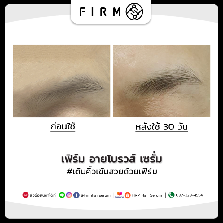 โปรด่วน-1-แถม-1-firm-เซรั่ม-ปลูกคิ้ว-2-มล-คิ้วเข้ม-ขนดก-ผมหนา-ตาสวย-คิ้วเข้มธรรมชาติ-ปลูกหนวด-ปลูกผม-จอน-firm-brows-amp-lashserum-hair