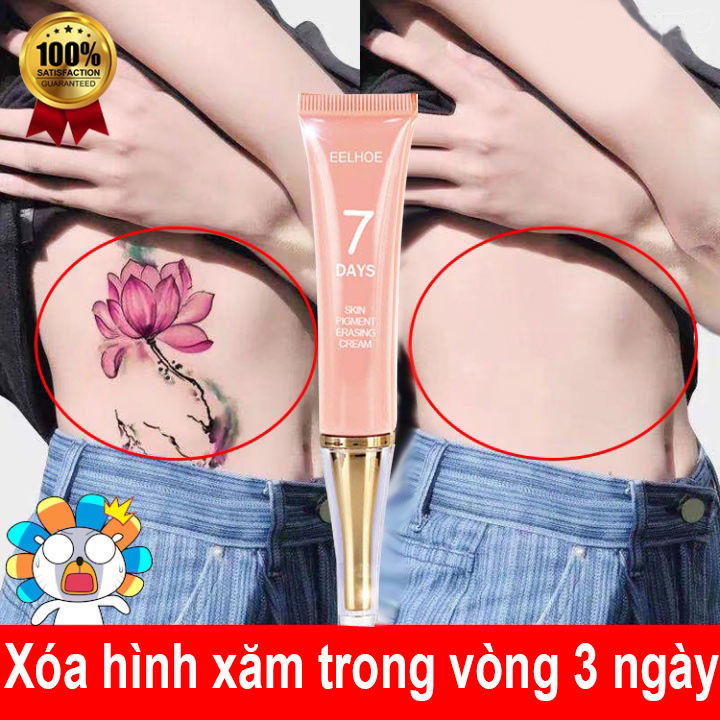 Nơi xóa hình xăm không để lại sẹo tốt nhất tại tphcm | shapeline.vn