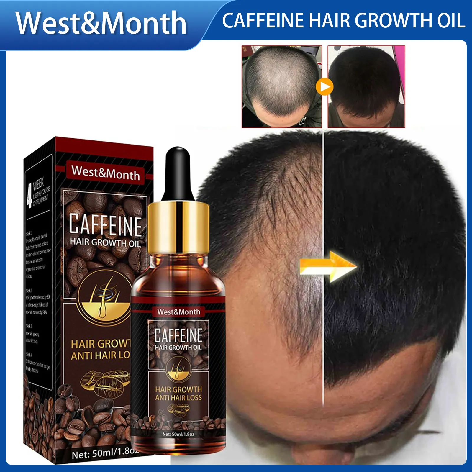 Hot 】West Month Caffeine Hair Growth Oil Hair Loss Treatment Oil Hair Loss Supplement Hair Growth Essential Oil Hair Loss Preventation Nourishing Hair Roots Hair Repair Treatment Oil Promote Hair Growth Hot 】West Month Caffeine Hair Growth Oil Hair Loss Treatment Oil Hair Loss Supplement Hair Growth Essential Oil Hair Loss Preventation Nourishing Hair Roots Hair Repair Treatment Oil Promote Hair Growth