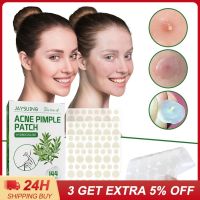 144PCS Invisible Acne Patch Skin Tag Removal Facial Blackhead Blemish Pimple Anti Acne Waterproof Stickers Skin Care Tools