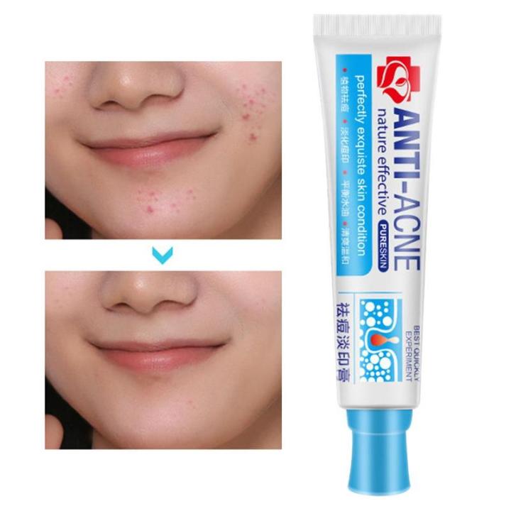 uclanka-traditional-chinese-medicine-acne-shrinking-pore-whitening-gel-whitening-moisturizing-acne