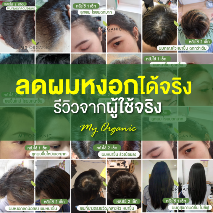 แก้ผมร่วงผมบาง-แก้ผมหงอก-แก้ผมขาว-แก้ผมบางผมร่วง-ผมหงอกกลับมาดำ-แบรนด์-my-organic-มายออร์แกนิค