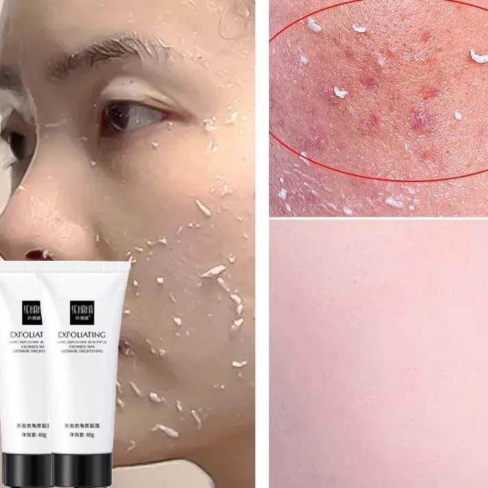 Original SENANA Skin Care Face Exfoliating Gel Whitening Moisturizer