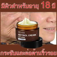 ครีมเรตินอลแท้ ครีมลดริ้วรอย ครีมบำรุงหน้า retinol cream ครีมหน้าเด้งใส ครีมยกกระชับ ครีมลบริ้วรอย ครีมทาหน้าขาว เรตินอลครีมแท้ ลดริ้วรอย