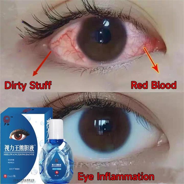 Eye drops original for clear vision dry eyes congestion eyes blurry ...