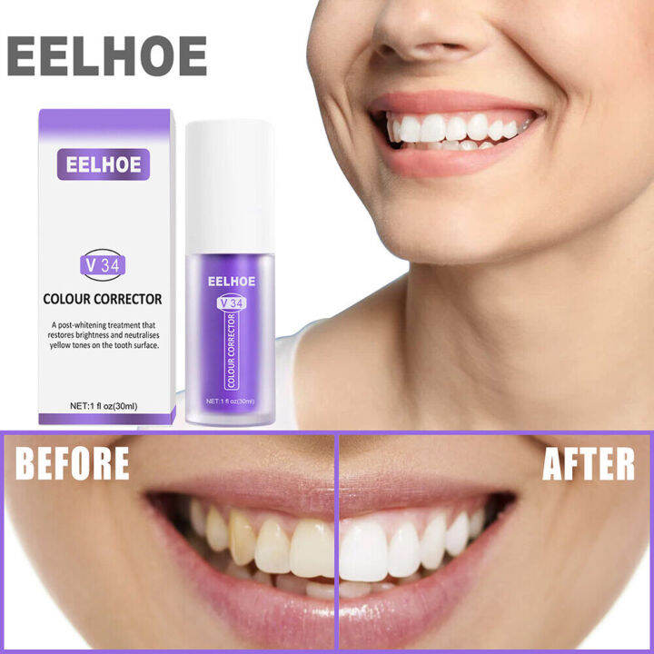 BEST CHOICE!! EELHOE V34 30ml Teeth Whitening Color Corrector Stain