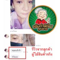 ส่งฟรี ผลิตภัณฑ์ไฝ ขี้แมลงวัน หูดตาปลาและติ่งเนื้อไฝ ขี้แมลงวัน แต้ม ทาไฝ คุณยาย(ของแท้เนื้อครีมมีสีเดียวคือสีครีมไข่)