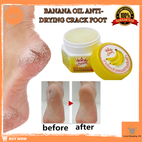 Anti-Drying Natural Banana Dead Skin Remover Soften Skin Crack