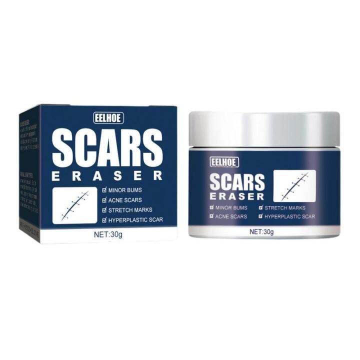 Scar Fade Cream Stretch Marks Removal Pimple Scars Skin Repair ...