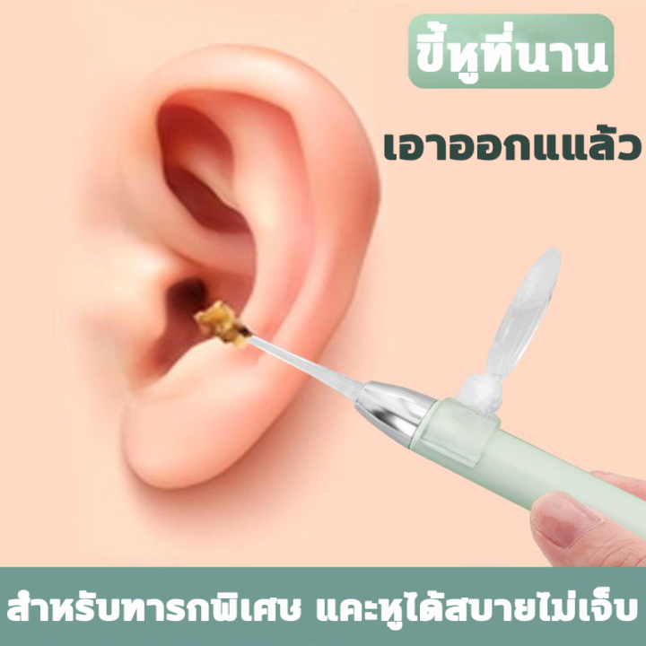 ปลอดภัย-ไม่ทำร้ายหู-ที่แคะหูมีไฟ-ที่แคะหูเด็ก-ชุดกำจัดขี้หู-แว่นขยายความชัดสูง-8-เท่า-ที่แคะหูมีไฟ-ที่แคะหู-เครื่องดูดขี้หู-ที่แคะขี้หู-ที่แคะหูเด็ก-ไม้แคะหูมีไฟ-แหนบแคะหู