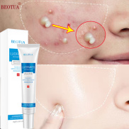 Kem Hết Mụn skin acne gel mụn Kem chấm mụn thâm cấp tốc cho nam giới nữ