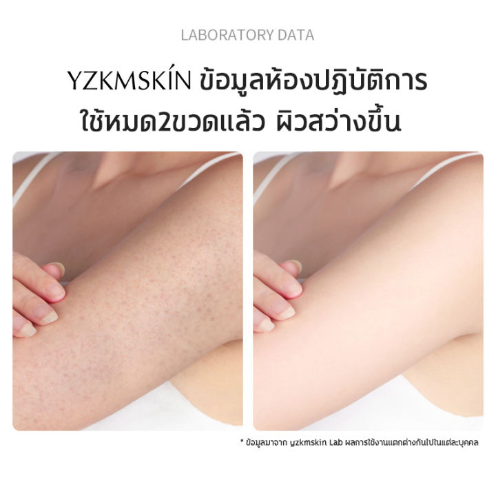 ขาวได้ทั้งตัว-yzkmskin-สคับขัดผิวขาว-สครับผิวกายไนอาซินาไมด์-ครีมขัดผิวกาย-เอกซ์โฟลิเอทติ้ง-บอดี้-สครับ-สกินสครับผิว-สครับขัดผิว-สคลับขัดผิวขาว-ขัดผิว-ขัดผิวขาวถาวร-สรับขัดผิว-ปรับปรุงผิวหนังไก่-สคับเ