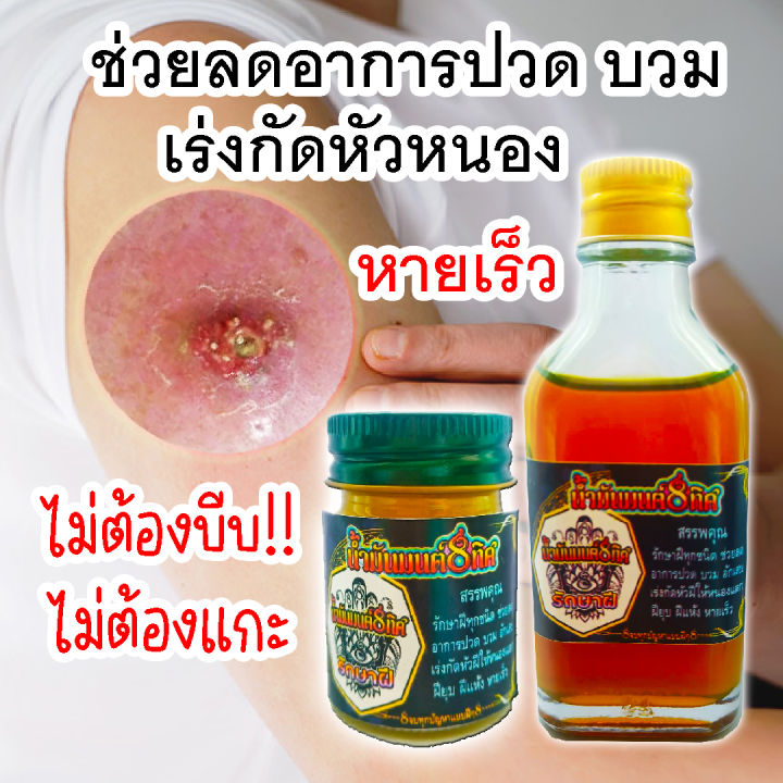 น้ำมันทาสำหรับนวดกัดหัวฝี-น้ำมันมนต์8ทิศ-กัดหัวฝีหนองอักเสบทุกชินด-สมานแผลปิดโพรงฝี-หนองแตกดูดหัวฝี-เร่งกัดหัวฝีทุกชนิด2-3วัน