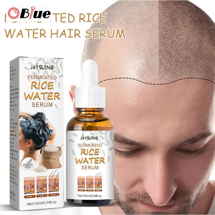 OBlue 10ml Fermented Rice Water Hair Growth Serum Stop Hair Loss Essence  Thinning Hair Hair Care Essence Nourish Scalp Anti Hair Loss for Women &  Men | Lazada PH