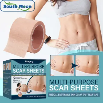  NUVADERMIS Silicone Scar Sheets, Tape, Strips - USA