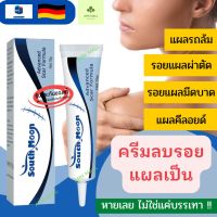 ?ของแท้จากเยอรมัน พร้อมส่ง?ครีมลดรอยแผลเป็น ลดรอยแผลเป็น รอยสิว ลบรอยแผลเป็น สำหรับรอยสิว แผลเผาไหม้ แผลเป็นจากการผ่าตัด