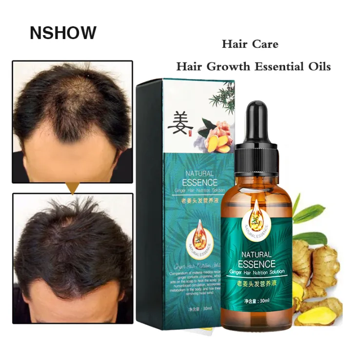 Hair Serum Hair Grower Fast Long Hair Hair Treatment Minoxidil Hair Grower  Castor Oil For Hair