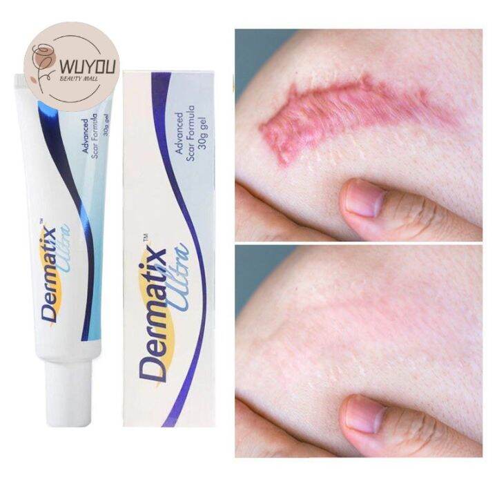 Australia Dermatix Scar Gel Acne Scars Treatment Scar Removal Cream
