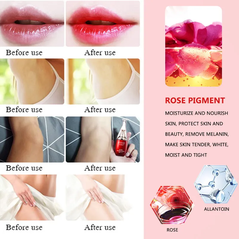 Women's Vaginal Lips Private Part Pink Underarm Intimate Whitening Dark  Nipple Bleaching Skin Care Body Whitening Cream | Lazada