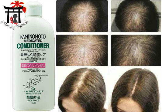 พร้อมส่ง-kaminomoto-shampoo-conditioner-300-ml-นำเข้าจากญี่ปุ่น-แชมพู-ครีมนวด-ปลูกผม-รักษาผมร่วง-ขายดีอันดับ1-แชมพู-ครีมนวด