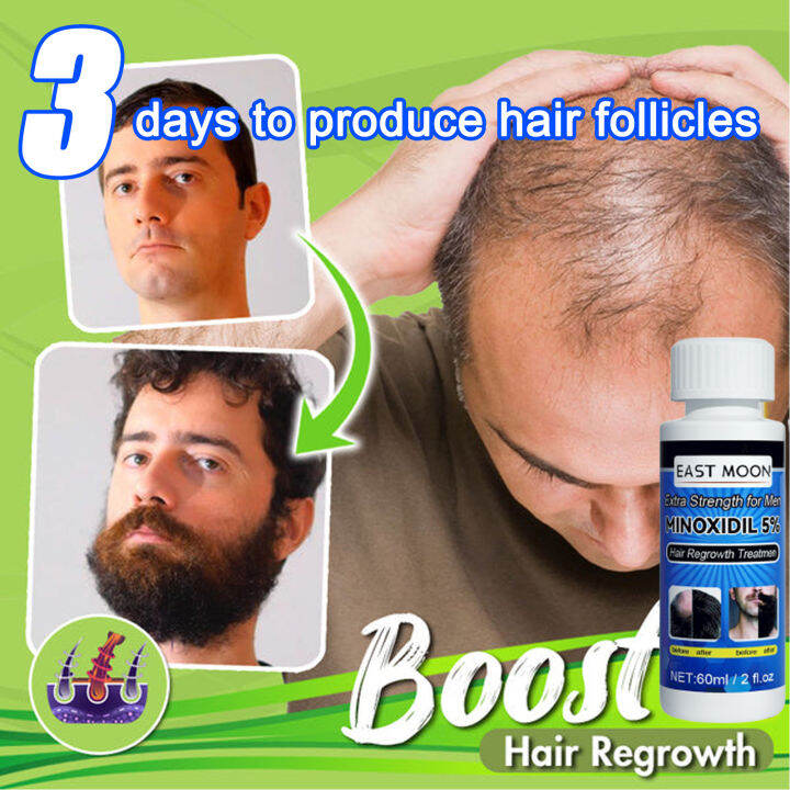 Minoxidil 5% Hair Growth 60ML Fast Powerful Hair Grower Hair Care 100% ...