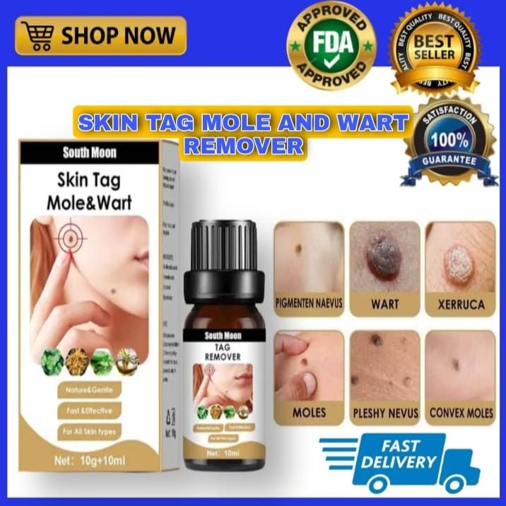 Sale 100 Effective South Moon Skin Tag Mole And Wart Skin Dark Spot For Callus Remover