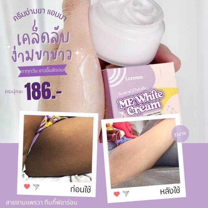 ส่งฟรี-1-ชิ้น-ครีมทาง่ามขาแอนนาme-white-cream