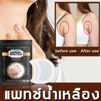 【จัดส่งที่รวดเร็ว】Accessory Breast patch เต้านมส่วนเกินหายไป แผ่นแปะกำจัด ก้อนเนื้อใต้ผิวหนัง（ก้อนรักแร้ ก้อนไขมัน น้ำเหลืองเสีย ต่อมน้ำเหลืองใต้ไข่ ต่อมน้ำเหลืองที่คอ ต่อมน้ำเหลืองบริเวณรักแร้ ครีมทาซีสก้อนไขมัน ครีมกำจัดเนื้องอกไขมัน ครีมสลายซีสต์ ）