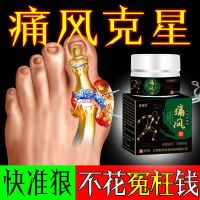 Special Effect Gout Ointment For Crystal Joint Pain Big Toe Swelling Finger